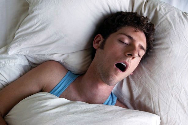 Oral Sleep Apnea (Snoring)